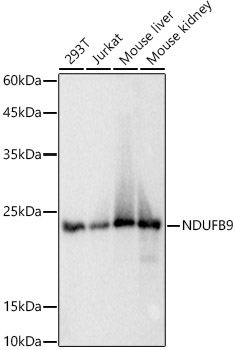 Western blot analysis of various lysates using NDUFB9 Rabbit mAb at 1:1000 dilution.|Secondary antibody: HRP-conjugated Goat anti-Rabbit IgG (H+L) at 1:10000 dilution.|Lysates/proteins: 25μg per lane.|Blocking buffer: 3% nonfat dry milk in TBST.|Detection: ECL Basic Kit.|Exposure time: 1s.
