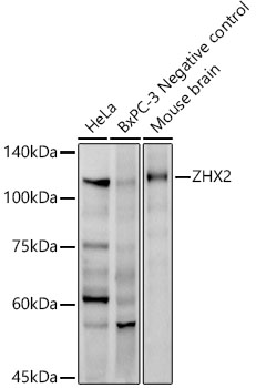 Western blot analysis of various lysates, using ZHX2 Rabbit mAb at 1:1000 dilution.|Secondary antibody: HRP-conjugated Goat anti-Rabbit IgG (H+L) at 1:10000 dilution.|Lysates/proteins: 25μg per lane.|Blocking buffer: 3% nonfat dry milk in TBST.|Detection: ECL Enhanced Kit.|Exposure time: 45s.