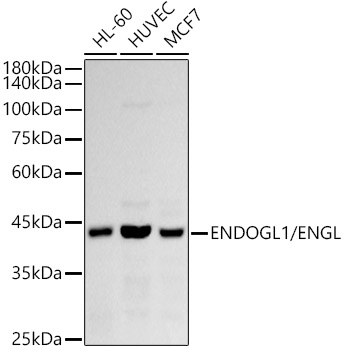 Western blot analysis of various lysates using ENDOGL1/ENGL Rabbit mAb at 1:1000 dilution.|Secondary antibody: HRP-conjugated Goat anti-Rabbit IgG (H+L) at 1:10000 dilution.|Lysates/proteins: 25μg per lane.|Blocking buffer: 3% nonfat dry milk in TBST.|Detection: ECL Basic Kit.|Exposure time: 90s.