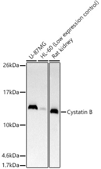 Western blot analysis of various lysates using Cystatin B Rabbit mAb at 1:500 dilution.|Secondary antibody: HRP-conjugated Goat anti-Rabbit IgG (H+L) at 1:10000 dilution.|Lysates/proteins: 25μg per lane.|Blocking buffer: 3% nonfat dry milk in TBST.|Detection: ECL Basic Kit.|Exposure time: 30s.