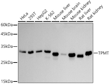 Western blot analysis of various lysates using TPMT Rabbit mAb at 1:1000 dilution.|Secondary antibody: HRP-conjugated Goat anti-Rabbit IgG (H+L) at 1:10000 dilution.|Lysates/proteins: 25μg per lane.|Blocking buffer: 3% nonfat dry milk in TBST.|Detection: ECL Basic Kit.|Exposure time: 30s.