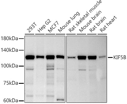 Western blot analysis of various lysates using KIF5B Rabbit mAb at 1:500 dilution.|Secondary antibody: HRP-conjugated Goat anti-Rabbit IgG (H+L) at 1:10000 dilution.|Lysates/proteins: 25μg per lane.|Blocking buffer: 3% nonfat dry milk in TBST.|Detection: ECL Basic Kit.|Exposure time: 3s.