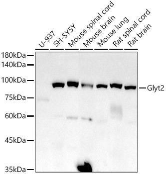Western blot analysis of various lysates using Glyt2 Rabbit mAb at 1:1000 dilution.|Secondary antibody: HRP-conjugated Goat anti-Rabbit IgG (H+L) at 1:10000 dilution.|Lysates/proteins: 25μg per lane.|Blocking buffer: 3% nonfat dry milk in TBST.|Detection: ECL Basic Kit.|Exposure time: 180s.