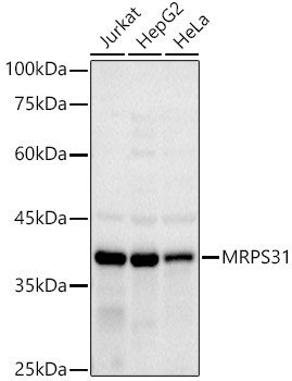 Western blot analysis of various lysates using MRPS31 Rabbit mAb at 1:1000 dilution.|Secondary antibody: HRP-conjugated Goat anti-Rabbit IgG (H+L) at 1:10000 dilution.|Lysates/proteins: 25μg per lane.|Blocking buffer: 3% nonfat dry milk in TBST.|Detection: ECL Basic Kit.|Exposure time: 180s.
