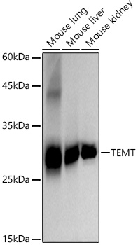 Western blot analysis of various lysates using TEMT Rabbit mAb at 1:2000 dilution.|Secondary antibody: HRP-conjugated Goat anti-Rabbit IgG (H+L) at 1:10000 dilution.|Lysates/proteins: 25μg per lane.|Blocking buffer: 3% nonfat dry milk in TBST.|Detection: ECL Basic Kit.|Exposure time: 10s.