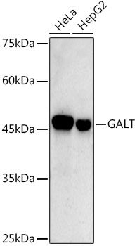 Western blot analysis of various lysates using GALT Rabbit mAb at 1:500 dilution.|Secondary antibody: HRP-conjugated Goat anti-Rabbit IgG (H+L) at 1:10000 dilution.|Lysates/proteins: 25μg per lane.|Blocking buffer: 3% nonfat dry milk in TBST.|Detection: ECL Basic Kit.|Exposure time: 90s.