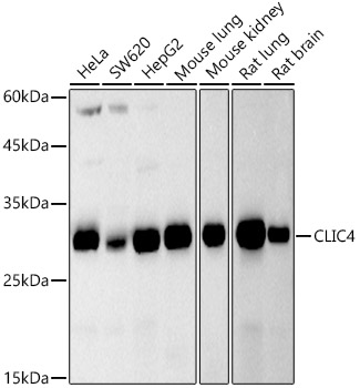 Western blot analysis of various lysates, using CLIC4 Rabbit mAb at 1:500 dilution.|Secondary antibody: HRP-conjugated Goat anti-Rabbit IgG (H+L) at 1:10000 dilution.|Lysates/proteins: 25μg per lane.|Blocking buffer: 3% nonfat dry milk in TBST.|Detection: ECL Basic Kit.|Exposure time: 90s.