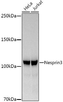 Western blot analysis of various lysates, using Nesprin3 Rabbit mAb at1:1000 dilution.|Secondary antibody: HRP-conjugated Goat anti-Rabbit IgG (H+L) at 1:10000 dilution.|Lysates/proteins: 25μg per lane.|Blocking buffer: 3% nonfat dry milk in TBST.|Detection: ECL Basic Kit.|Exposure time: 60s.