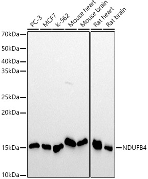 Western blot analysis of various lysates using NDUFB4 Rabbit mAb at1:1000 dilution.|Secondary antibody: HRP-conjugated Goat anti-Rabbit IgG (H+L) at 1:10000 dilution.|Lysates/proteins: 25μg per lane.|Blocking buffer: 3% nonfat dry milk in TBST.|Detection: ECL Basic Kit.|Exposure time: 30s.