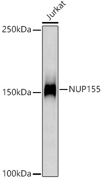 Western blot analysis of lysates from Jurkat cells, using NUP155 Rabbit mAb at1:1000 dilution.|Secondary antibody: HRP-conjugated Goat anti-Rabbit IgG (H+L) at 1:10000 dilution.|Lysates/proteins: 25μg  per lane.|Blocking buffer: 3% nonfat dry milk in TBST.|Detection: ECL Basic Kit.|Exposure time: 180s.