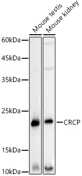 Western blot analysis of various lysates using CRCP Rabbit mAb at1:500 dilution.|Secondary antibody: HRP-conjugated Goat anti-Rabbit IgG (H+L) at 1:10000 dilution.|Lysates/proteins: 25μg per lane.|Blocking buffer: 3% nonfat dry milk in TBST.|Detection: ECL Basic Kit.|Exposure time: 3s.
