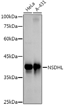 Western blot analysis of various lysates using NSDHL Rabbit mAb at 1:1000 dilution.|Secondary antibody: HRP-conjugated Goat anti-Rabbit IgG (H+L) at 1:10000 dilution.|Lysates/proteins: 25μg per lane.|Blocking buffer: 3% nonfat dry milk in TBST.|Detection: ECL Basic Kit.|Exposure time: 60s.