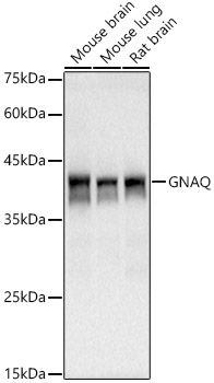 Western blot analysis of various lysates using GNAQ Rabbit mAb at1:1000 dilution.|Secondary antibody: HRP-conjugated Goat anti-Rabbit IgG (H+L) at 1:10000 dilution.|Lysates/proteins: 25μg per lane.|Blocking buffer: 3% nonfat dry milk in TBST.|Detection: ECL Basic Kit.|Exposure time: 60s.