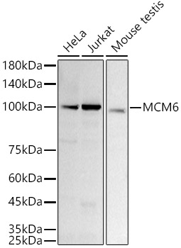 Western blot analysis of various lysates using [KD Validated] MCM6 Rabbit mAb at1:1000 dilution.|Secondary antibody: HRP-conjugated Goat anti-Rabbit IgG (H+L) at 1:10000 dilution.|Lysates/proteins: 25μg per lane.|Blocking buffer: 3% nonfat dry milk in TBST.|Detection: ECL Basic Kit.|Exposure time: 60s.