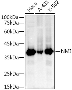 Western blot analysis of various lysates using NMI Rabbit mAb at1:1000 dilution.|Secondary antibody: HRP-conjugated Goat anti-Rabbit IgG (H+L) at 1:10000 dilution.|Lysates/proteins: 25μg per lane.|Blocking buffer: 3% nonfat dry milk in TBST.|Detection: ECL Basic Kit.|Exposure time: 180s.
