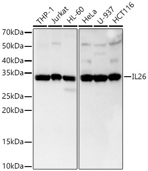 Western blot analysis of various lysates, using IL26 Rabbit mAb at 1:1000 dilution.|Secondary antibody: HRP-conjugated Goat anti-Rabbit IgG (H+L) at 1:10000 dilution.|Lysates/proteins: 25μg per lane.|Blocking buffer: 3% nonfat dry milk in TBST.|Detection: ECL Basic Kit.|Exposure time: 30s.