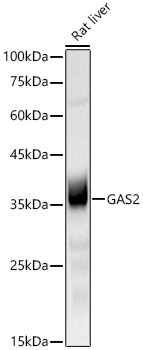 Western blot analysis of lysates from Rat liver, using GAS2 Rabbit mAb at 1:900 dilution incubated overnight at 4℃.|Secondary antibody: HRP-conjugated Goat anti-Rabbit IgG (H+L) at 1:10000 dilution.|Lysates/proteins: 25 μg per lane.|Blocking buffer: 3% nonfat dry milk in TBST.|Detection: ECL Basic Kit.|Exposure time: 30 s.