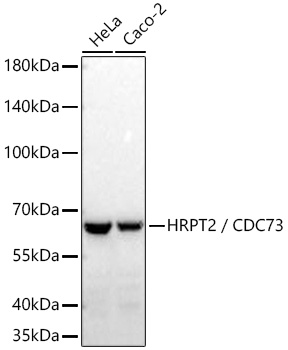 Western blot analysis of various lysates using HRPT2 / CDC73 Rabbit mAb at 1:2000 dilution incubated at room temperature for 1.5 hours.|Secondary antibody: HRP-conjugated Goat anti-Rabbit IgG (H+L) at 1:10000 dilution.|Lysates/proteins: 25 μg per lane.|Blocking buffer: 3% nonfat dry milk in TBST.|Detection: ECL Basic Kit.|Exposure time: 45 s.