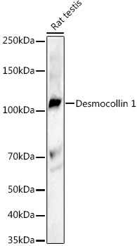 Western blot analysis of lysates from Rat testis, using Desmocollin 1 Rabbit mAb at 1:1000 dilution.|Secondary antibody: HRP-conjugated Goat anti-Rabbit IgG (H+L) at 1:10000 dilution.|Lysates/proteins: 25μg per lane.|Blocking buffer: 3% nonfat dry milk in TBST.|Detection: ECL Basic Kit.|Exposure time: 180s.