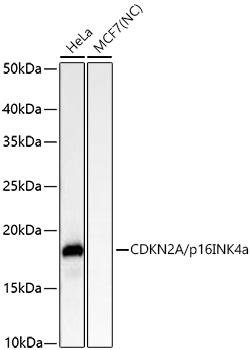 Western blot analysis of various lysates using [KO Validated] CDKN2A/p16INK4a Rabbit mAb at 1:15000 dilution incubated overnight at 4℃.|Secondary antibody: HRP-conjugated Goat anti-Rabbit IgG (H+L) at 1:10000 dilution.|Lysates/proteins: 25 μg per lane.|Blocking buffer: 3% nonfat dry milk in TBST.|Detection: ECL Basic Kit.|Negative control (NC): MCF7.|Exposure time: 10 s.