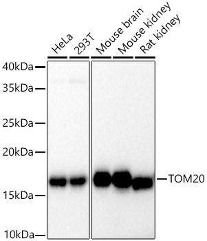 Western blot analysis of various lysates using PSFlo 647 Conjugated TOM20 Rabbit mAb at 1:5000 dilution incubated overnight at 4℃.|Secondary antibody: HRP-conjugated Goat anti-Rabbit IgG (H+L) at 1:10000 dilution.|Lysates/proteins: 25 μg per lane.|Blocking buffer: 3% nonfat dry milk in TBST.|Detection: ECL Basic Kit.|Exposure time: 30s.