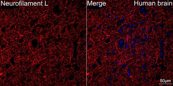 Confocal imaging of Human brain tissue using Neurofilament L Rabbit mAb (Red). DAPI was used for nuclear staining (blue). Objective: 40x.Perform high pressure antigen retrieval with 10 mM citrate buffer pH 6.0 before commencing with IF staining protocol.