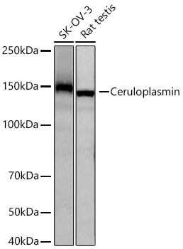Western blot analysis of various lysates using Ceruloplasmin Rabbit mAb at 1:1000 dilution incubated overnight at 4℃.|Secondary antibody: HRP-conjugated Goat anti-Rabbit IgG (H+L) at 1:10000 dilution.|Lysates/proteins: 25 μg per lane.|Blocking buffer: 3% nonfat dry milk in TBST.|Detection: ECL Basic Kit.|Exposure time: 20s.
