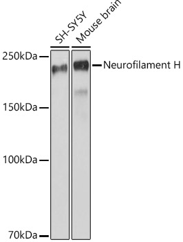 Western blot analysis of various lysates, using Neurofilament H Rabbit mAb at 1:1000 dilution.|Secondary antibody: HRP-conjugated Goat anti-Rabbit IgG (H+L) at 1:10000 dilution.|Lysates/proteins: 25μg per lane.|Blocking buffer: 3% nonfat dry milk in TBST.|Detection: ECL Basic Kit.|Exposure time: 3s.