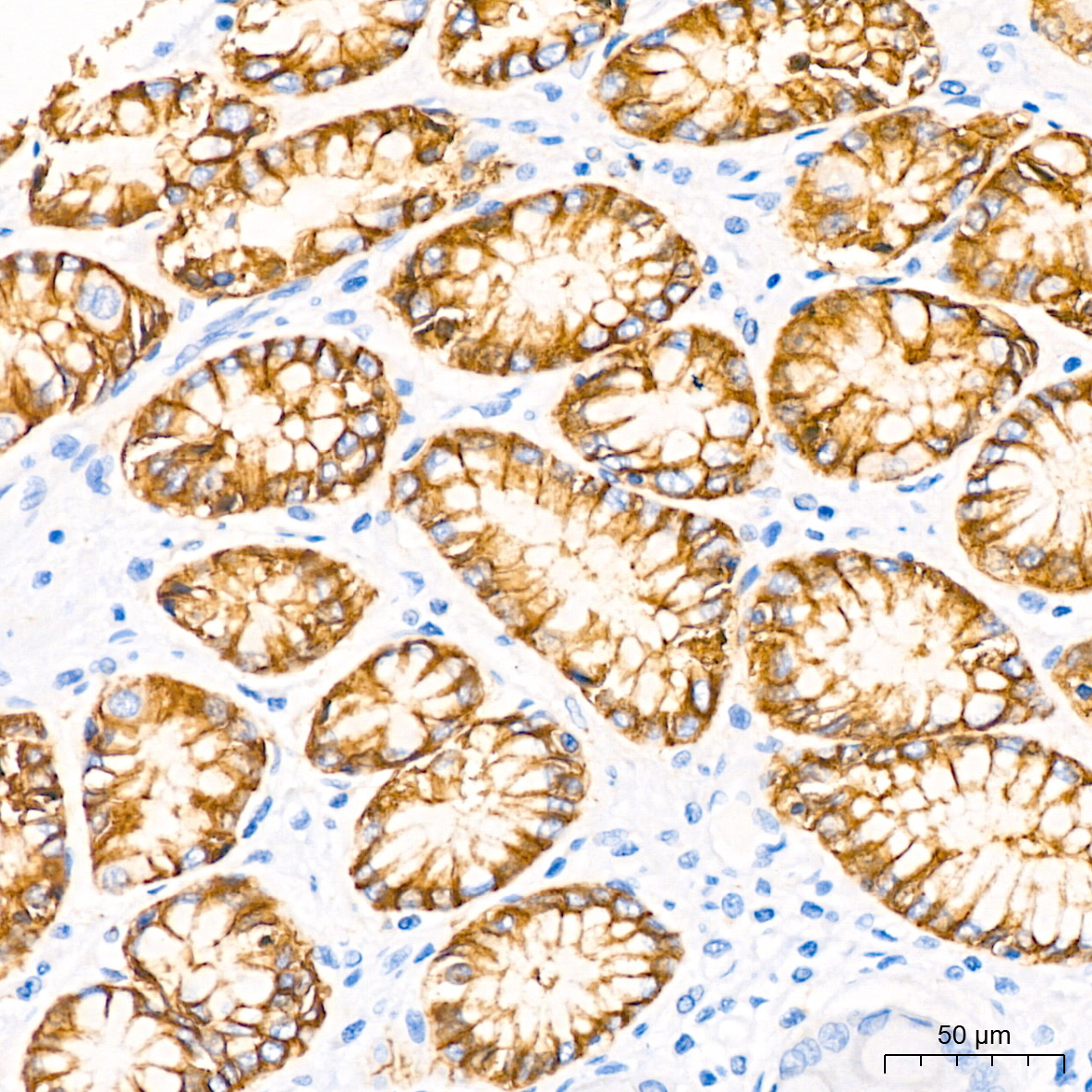Immunohistochemistry analysis of paraffin-embedded Human stomach using CLDN18.2 Rabbit mAb at dilution of 1:50 (40x lens). High pressure antigen retrieval performed with 0.01M Tris/EDTA Buffer (pH 9.0) prior to IHC staining.