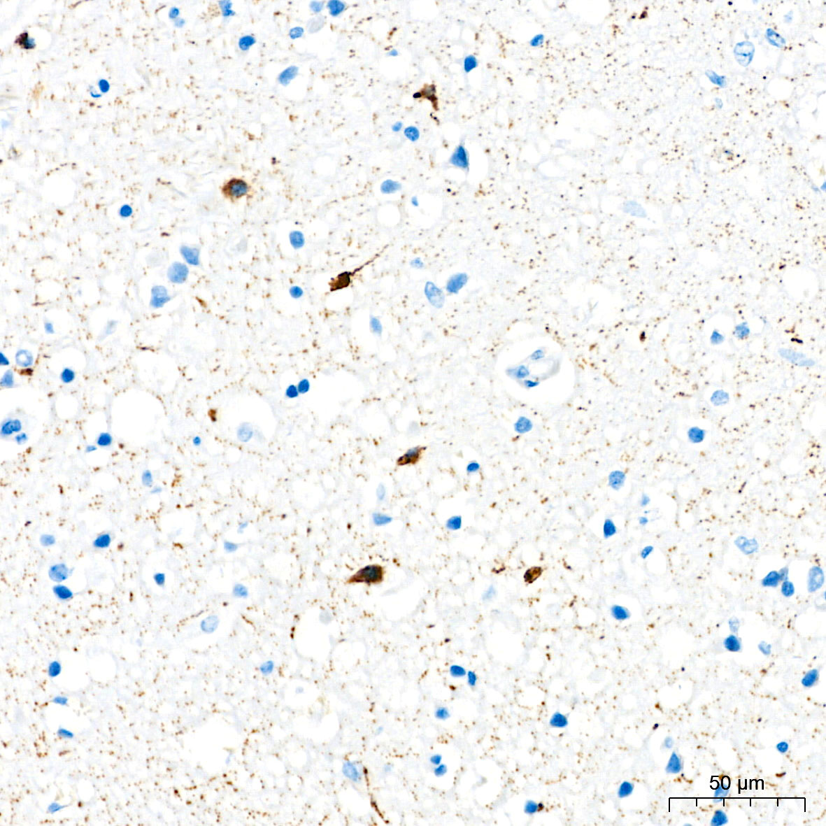 Immunohistochemistry analysis of paraffin-embedded Human brain tissue using Somatostatin (SST) Rabbit mAb at a dilution of 1:1000 (40x lens). High pressure antigen retrieval performed with 0.01M Citrate Buffer(pH 6.0) prior to IHC staining.