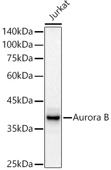 Western blot analysis of lysates from Jurkat cells, using [KD Validated] Aurora B Rabbit mAb at 1:1000 dilution.|Secondary antibody: HRP-conjugated Goat anti-Rabbit IgG (H+L) at 1:10000 dilution.|Lysates/proteins: 25μg per lane.|Blocking buffer: 3% nonfat dry milk in TBST.|Detection: ECL Basic Kit.|Exposure time: 30s.
