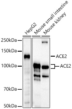 Western blot analysis of various lysates using ACE2 Rabbit mAb at1:1000 dilution.|Secondary antibody: HRP-conjugated Goat anti-Rabbit IgG (H+L) at1:10000 dilution.|Lysates/proteins: 25μg per lane.|Blocking buffer: 3% nonfat dry milk in TBST.|Detection: ECL Basic Kit.|Exposure time: 180s.