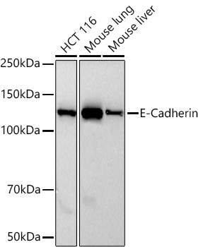 Western blot analysis of various lysates using E-Cadherin Rabbit mAb at 1:1000 dilution incubated overnight at 4℃.|Secondary antibody: HRP-conjugated Goat anti-Rabbit IgG (H+L) at 1:10000 dilution.|Lysates/proteins: 25 μg per lane.|Blocking buffer: 3% nonfat dry milk in TBST.|Detection: ECL Basic Kit.|Exposure time: 30s.