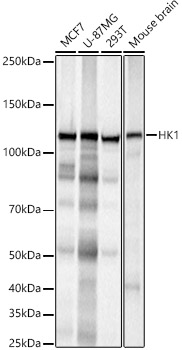 Western blot analysis of various lysates, using [KO Validated] HK1 Rabbit mAb at 1:1000 dilution.|Secondary antibody: HRP-conjugated Goat anti-Rabbit IgG (H+L) at 1:10000 dilution.|Lysates/proteins: 25μg  per lane.|Blocking buffer: 3% nonfat dry milk in TBST.|Detection: ECL Basic Kit.|Exposure time: 3s.