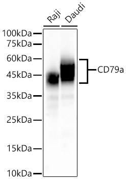 Western blot analysis of various lysates, using CD79a Rabbit mAb at 1:10000 dilution.|Secondary antibody: HRP-conjugated Goat anti-Rabbit IgG (H+L) at 1:10000 dilution.|Lysates/proteins: 25μg per lane.|Blocking buffer: 3% nonfat dry milk in TBST.|Detection: ECL Basic Kit.|Exposure time: 3s.