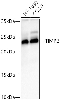 Western blot analysis of various lysates using TIMP2 Rabbit mAb at 1:1000 dilution incubated overnight at 4℃.|Secondary antibody: HRP-conjugated Goat anti-Rabbit IgG (H+L) at 1:10000 dilution.|Lysates/proteins: 25 μg per lane.|Blocking buffer: 3% nonfat dry milk in TBST.|Detection: ECL Basic Kit.|Exposure time: 20 s.