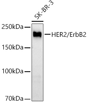 Western blot analysis of lysates from SK-BR-3 cells, using HER2/ErbB2 Rabbit mAb at 1:2000 dilution.|Secondary antibody: HRP-conjugated Goat anti-Rabbit IgG (H+L) at 1:10000 dilution.|Lysates/proteins: 25μg per lane.|Blocking buffer: 3% nonfat dry milk in TBST.|Detection: ECL Basic Kit.|Exposure time: 10s.