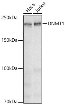 Western blot analysis of various lysates using [KD Validated] DNMT1 Rabbit mAb at 1:1000 dilution incubated overnight at 4℃.|Secondary antibody: HRP-conjugated Goat anti-Rabbit IgG (H+L) at 1:10000 dilution. |Lysates/proteins: 25 μg per lane.|Blocking buffer: 3% nonfat dry milk in TBST.|Detection: ECL Basic Kit|Exposure time: 30 s.