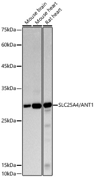 Western blot analysis of various lysates using [KO Validated] SLC25A4/ANT1 Rabbit mAb at 1:1000 dilution.| Secondary antibody: HRP-conjugated Goat anti-Rabbit IgG (H+L) at 1:10000 dilution.| Lysates / proteins: 25 μg per lane.| Blocking buffer: 3 % nonfat dry milk in TBST.| Detection: ECL Basic Kit.| Exposure time: 10s.