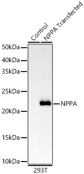 Western blot analysis of lysates from wild type (WT) and 293T cells transfected with NPPA using NPPA Rabbit mAb at 1:5000 dilution. |Secondary antibody: HRP-conjugated Goat anti-Rabbit IgG (H+L) at 1:10000 dilution.|Lysates/proteins: 25 μg per lane.|Blocking buffer: 3% nonfat dry milk in TBST.|Detection: ECL Enhanced Kit.|Exposure time: 60s.