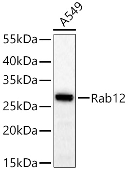 Western blot analysis of lysates from A549 cells using Rab12 Rabbit mAb at 1:2000 dilution incubated at room temperature for 1.5 hours.|Secondary antibody: HRP-conjugated Goat anti-Rabbit IgG (H+L) at 1:10000 dilution.|Lysates/proteins: 25 μg per lane.|Blocking buffer: 3% nonfat dry milk in TBST.|Detection: ECL Basic Kit.|Exposure time: 60s.