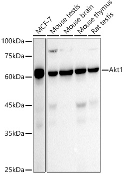Western blot analysis of various lysates using [KO Validated] AKT1 Rabbit mAb at1:1000 dilution.|Secondary antibody: HRP-conjugated Goat anti-Rabbit IgG (H+L) at1:10000 dilution.|Lysates/proteins: 25μg per lane.|Blocking buffer: 3% nonfat dry milk in TBST.|Detection: ECL Basic Kit.|Exposure time: 30s.