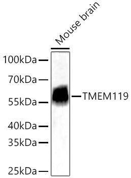 Western blot analysis of lysates from Mouse brain using TMEM119 Rabbit mAb at 1:12000 dilution incubated overnight at 4℃.|Secondary antibody: HRP-conjugated Goat anti-Rabbit IgG (H+L) at 1:10000 dilution.|Lysates/proteins: 25 μg per lane.|Blocking buffer: 3% nonfat dry milk in TBST.|Detection: ECL Basic Kit.|Exposure time: 45s.