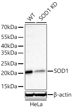 Western blot analysis of lysates from wild type (WT) and SOD1 knockdown (KD) HeLa cells using [KD Validated] SOD1 Rabbit mAb at 1:11000 dilution incubated overnight at 4℃.|Secondary antibody: HRP-conjugated Goat anti-Rabbit IgG (H+L) at 1:10000 dilution.|Lysates/proteins: 25 μg per lane.|Blocking buffer: 3% nonfat dry milk in TBST.|Detection: ECL Basic Kit.|Exposure time: 10s.