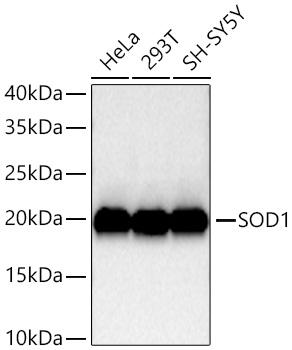 Western blot analysis of various lysates using SOD1 Rabbit mAb at 1:5000 dilution incubated overnight at 4℃.|Secondary antibody: HRP-conjugated Goat anti-Rabbit IgG (H+L) at 1:10000 dilution.|Lysates/proteins: 25 μg per lane.|Blocking buffer: 3% nonfat dry milk in TBST.|Detection: ECL Basic Kit.|Exposure time: 20s.