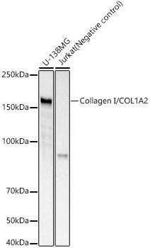 Western blot analysis of various lysates, using Collagen I/COL1A2 Rabbit mAb at  1:1000 dilution.|Secondary antibody: HRP-conjugated Goat anti-Rabbit IgG (H+L) at 1:10000 dilution.|Lysates/proteins: 25μg per lane.|Blocking buffer: 3% nonfat dry milk in TBST.|Detection: ECL Basic Kit.|Exposure time: 3s.