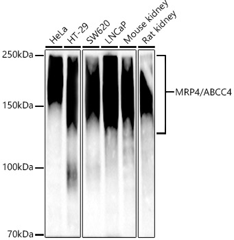 Western blot analysis of various lysates, using [KD Validated] MRP4/ABCC4 Rabbit mAb at 1:1000 dilution.|Secondary antibody: HRP-conjugated Goat anti-Rabbit IgG (H+L) at 1:10000 dilution.|Lysates/proteins: 25μg per lane.|Blocking buffer: 3% nonfat dry milk in TBST.|Detection: ECL Basic Kit.|Exposure time: 90s.
