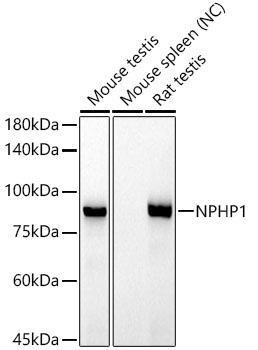 Western blot analysis of various lysates, using NPHP1 Rabbit mAb at 1:1000 dilution.|Secondary antibody: HRP-conjugated Goat anti-Rabbit IgG (H+L) at1:10000 dilution.|Lysates/proteins: 25μg per lane.|Blocking buffer: 3% nonfat dry milk in TBST.|Detection: ECL Basic Kit.|Negative control (NC): Mouse spleen|Exposure time: 90s.
