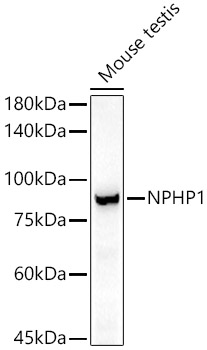 Western blot analysis of lysates from Mouse testis, using NPHP1 Rabbit mAb at 1:1000 dilution.|Secondary antibody: HRP-conjugated Goat anti-Rabbit IgG (H+L) at 1:10000 dilution.|Lysates/proteins: 25μg per lane.|Blocking buffer: 3% nonfat dry milk in TBST.|Detection: ECL Basic Kit.|Exposure time: 180s.