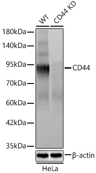 Western blot analysis of lysates from wild type (WT) and CD44 knockdown (KD) HeLa cells using CD44 Rabbit mAb at 1:10000 dilution incubated overnight at 4℃.|Secondary antibody: HRP-conjugated Goat anti-Rabbit IgG (H+L) at 1:10000 dilution.|Lysates/proteins: 25 μg per lane.|Blocking buffer: 3% nonfat dry milk in TBST.|Detection: ECL Basic Kit.|Exposure time: 15s.
